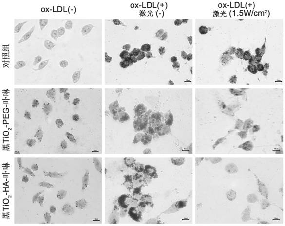 Application of nano material in preparation of medicine for treating atherosclerosis