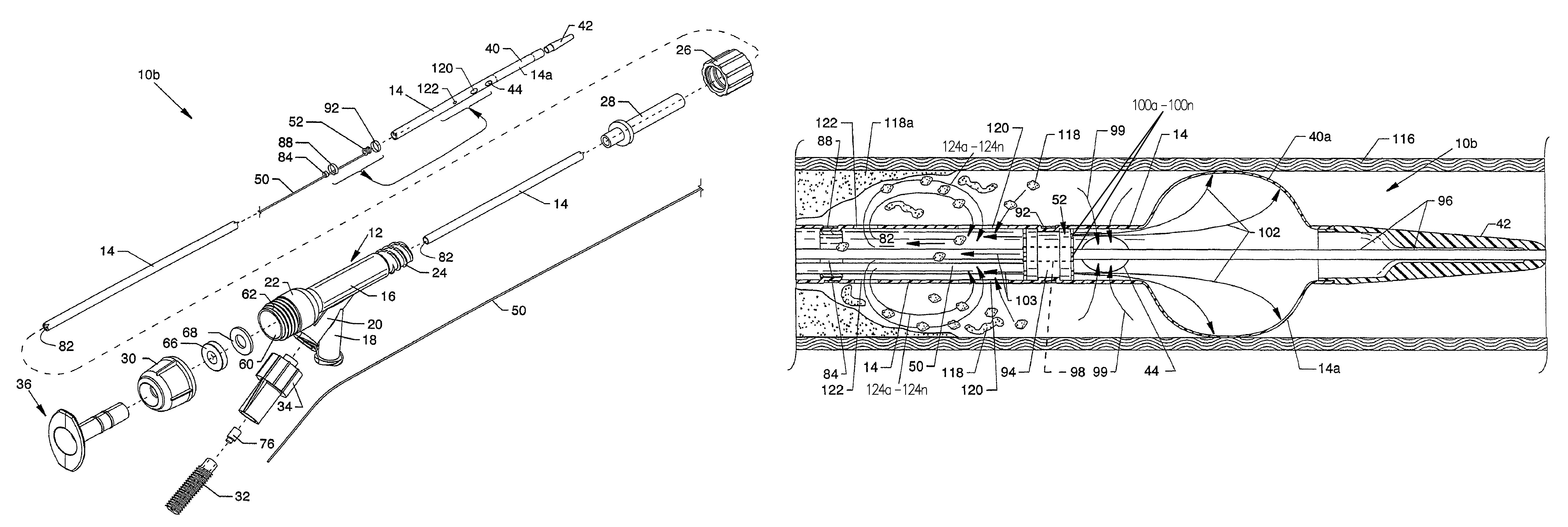 Rheolytic thrombectomy catheter with self-inflating distal balloon