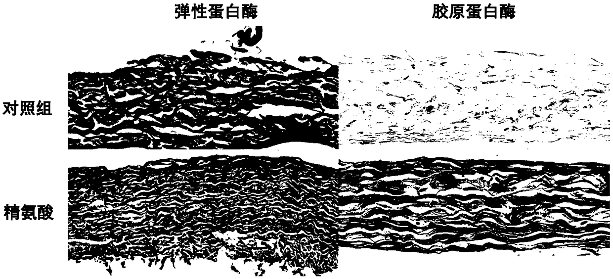 Treatment method for improving anti-calcification performance of biological material, and biological material