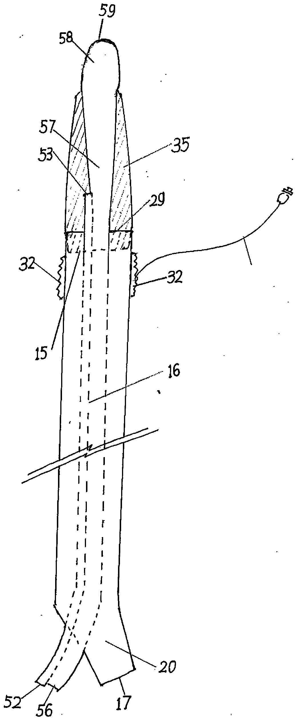 Supraglottic device capable of positive pressure ventilation and non-invasive tube intubation