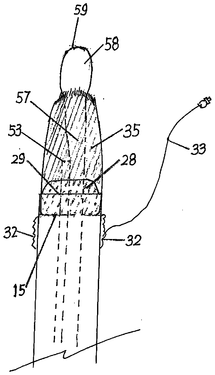 Supraglottic device capable of positive pressure ventilation and non-invasive tube intubation