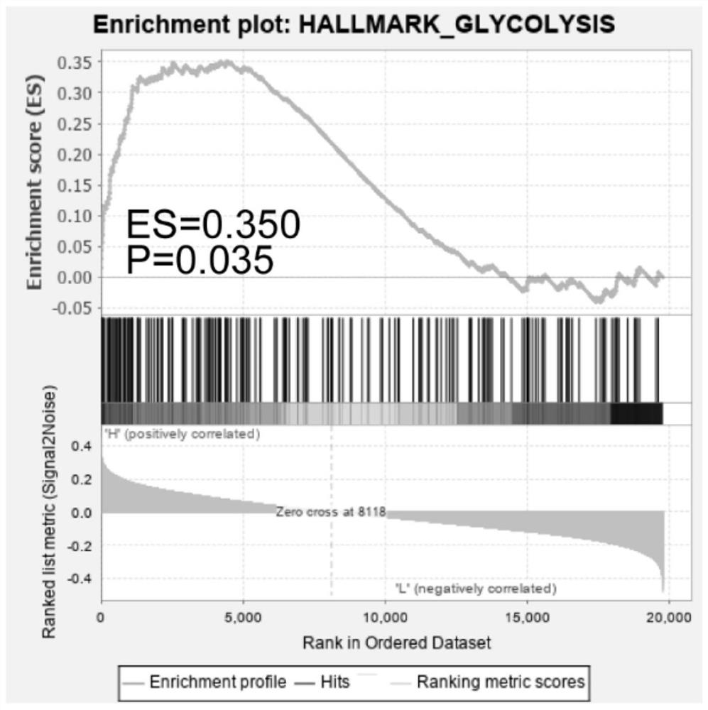 Osteosarcoma prognosis marker and prognosis evaluation model