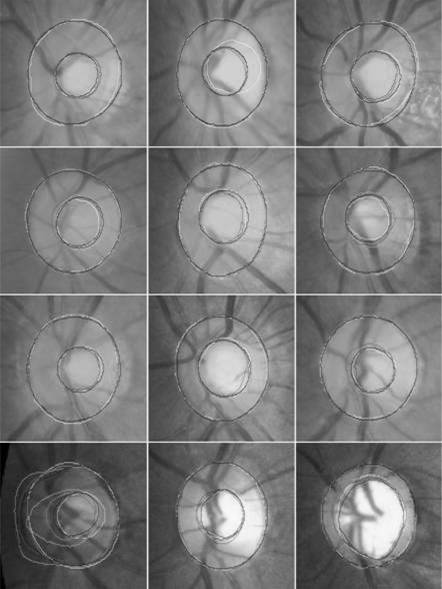 A bidirectional cross-connected convolutional neural network for image segmentation