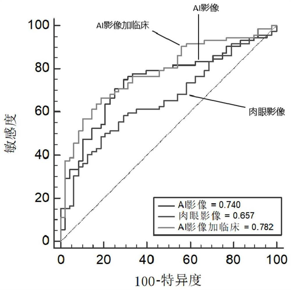 A method, medium and terminal device for predicting the risk of early recurrence of hepatocellular carcinoma after surgery