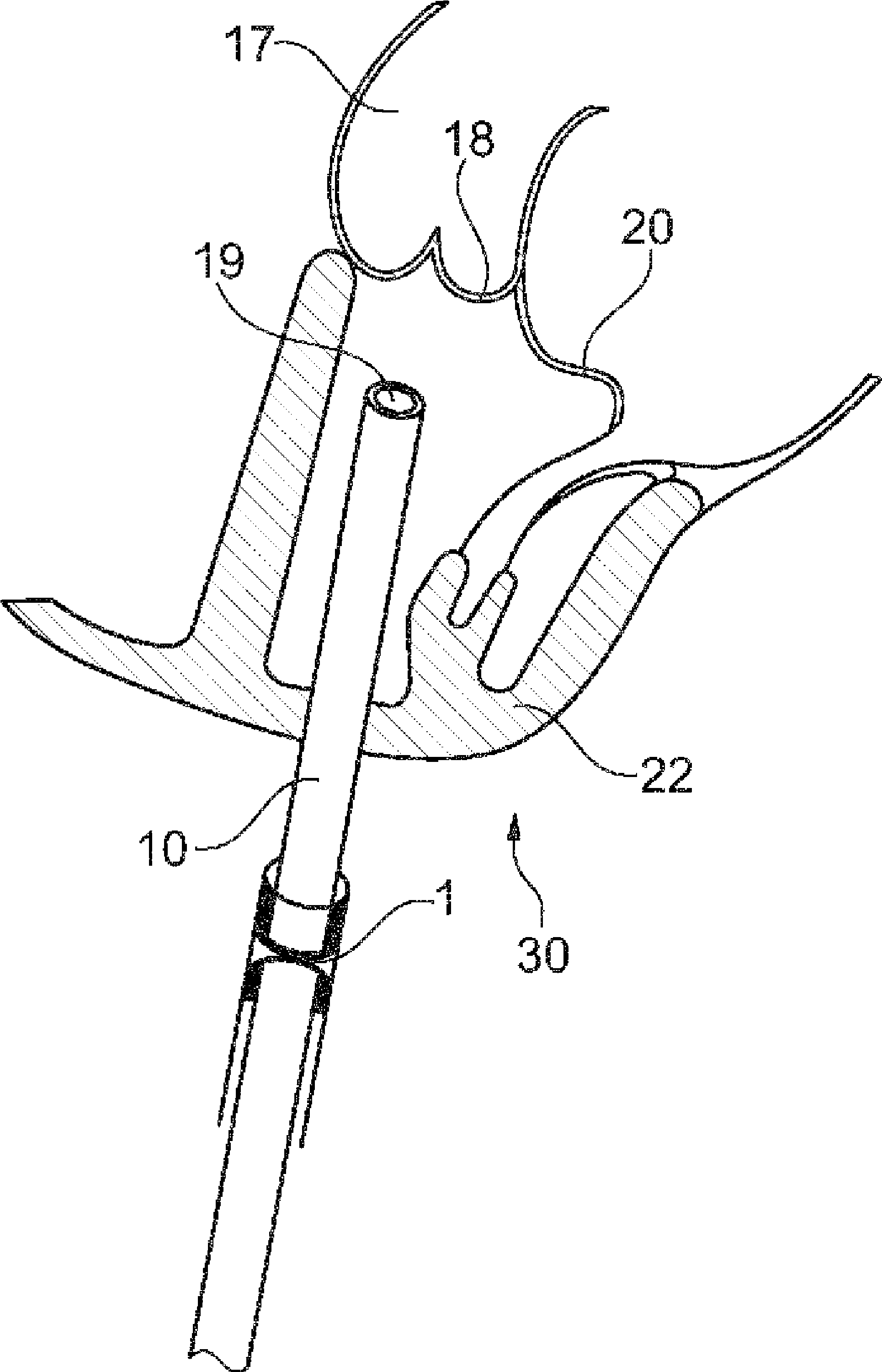 A collapsible medical closing device, a method and a medical system for delivering an object