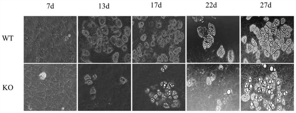 Application of substance for regulating level of NLRP6 gene and/or expression product thereof