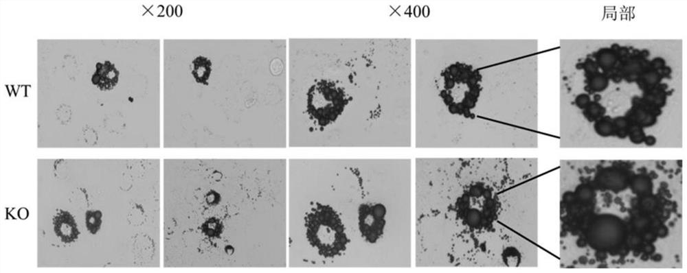 Application of substance for regulating level of NLRP6 gene and/or expression product thereof