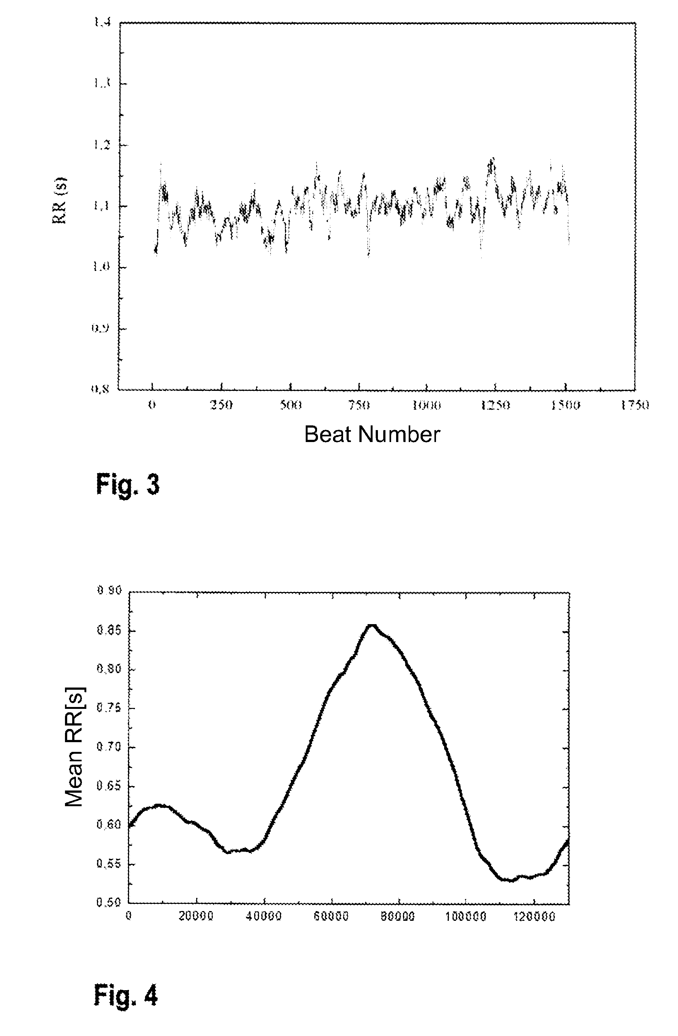 Diagnosis of sleep apnea