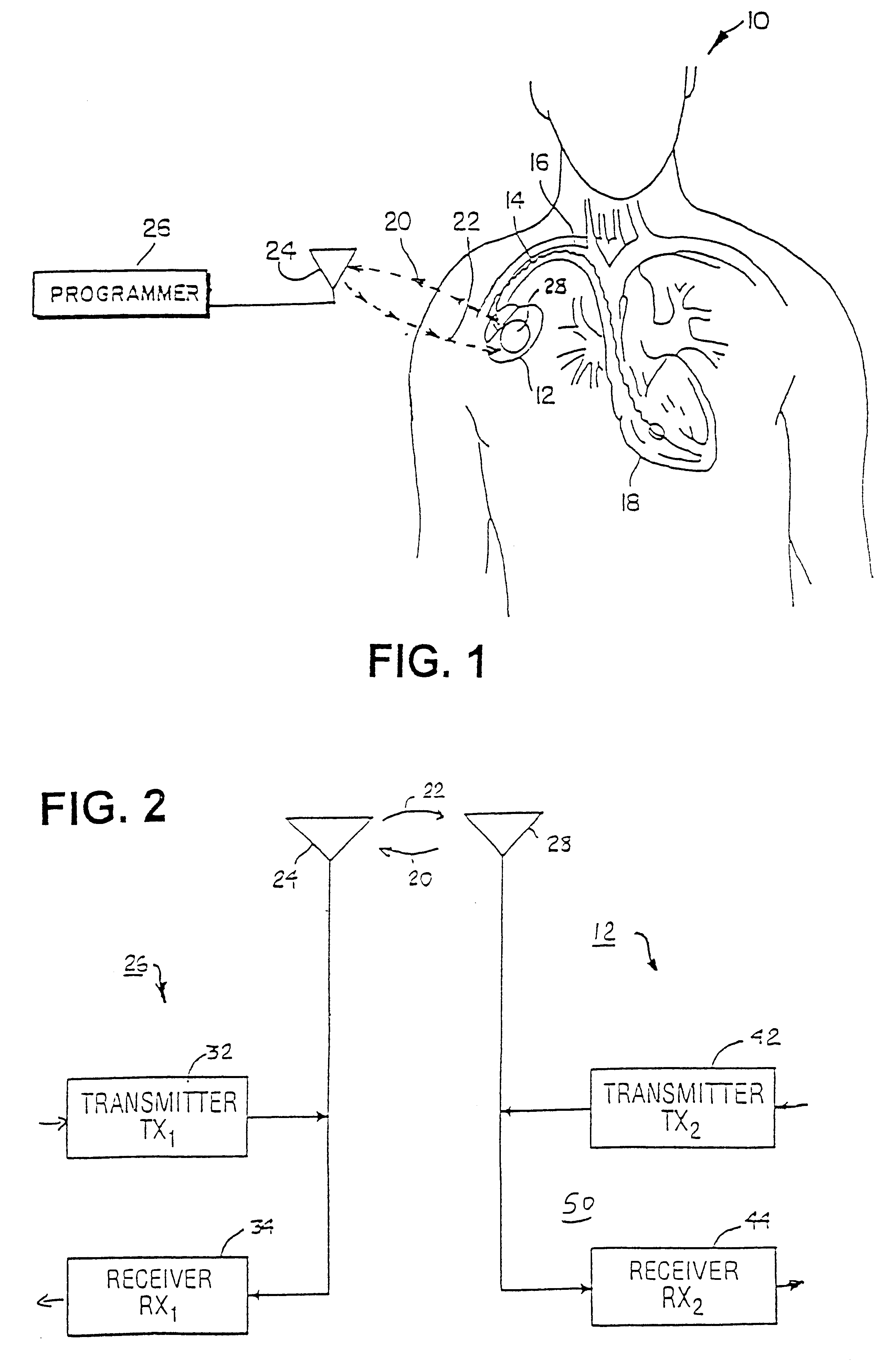 Low energy consumption RF telemetry control for an implantable medical device