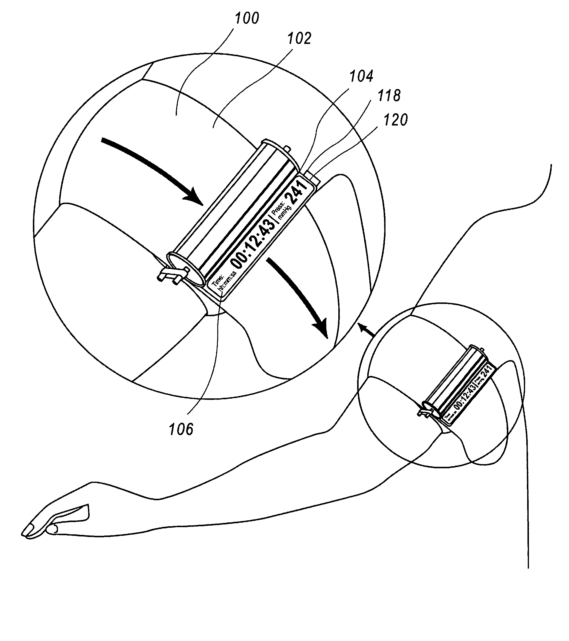 Tourniquet timer