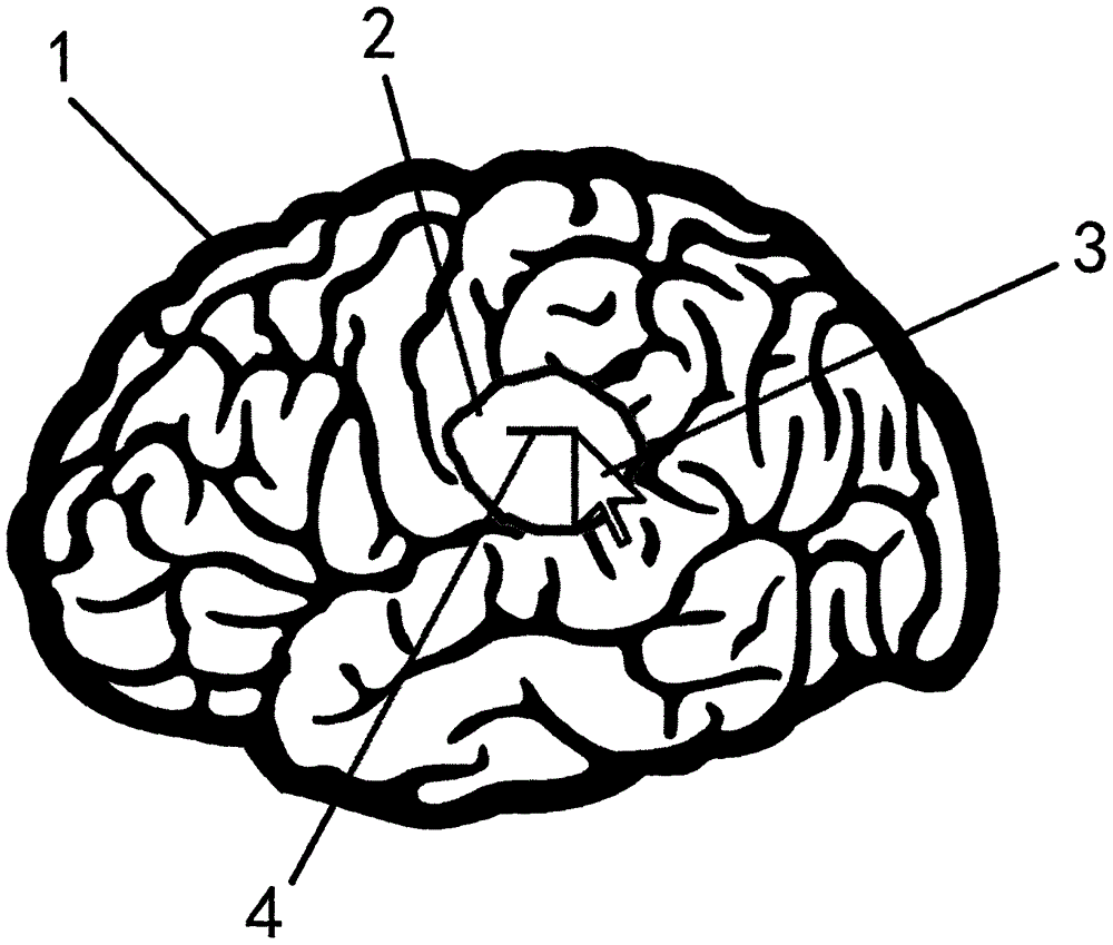 Brain tumor image segmentation method based on multi-sequence MR (Magnetic Resonance) image correlation information