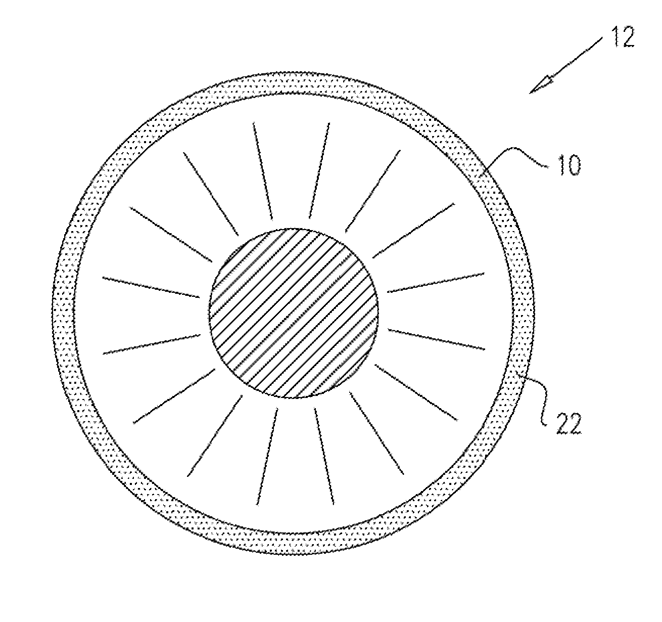 Injectable hydrogel implant for treating glaucoma