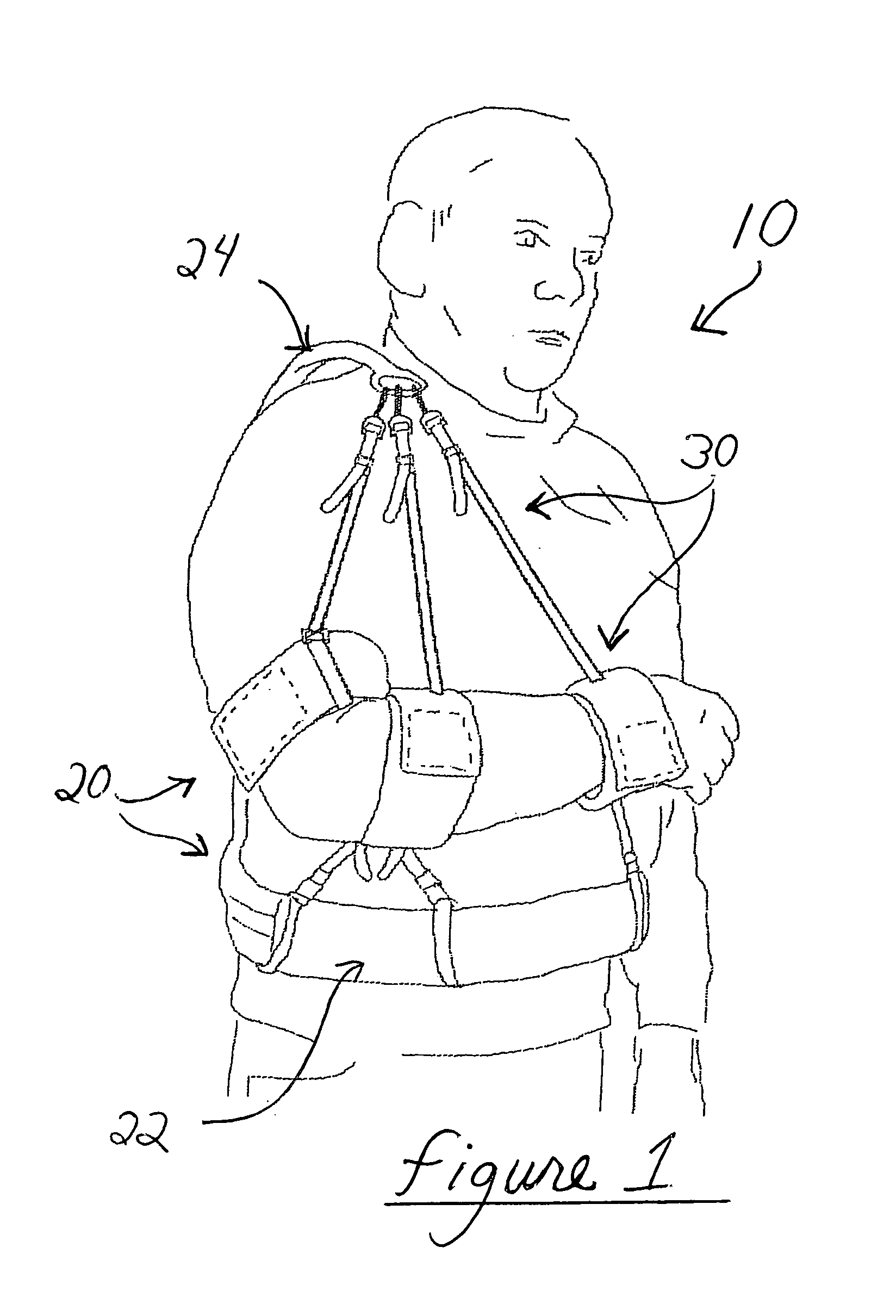 Arm sling apparatus allowing movement or total immobilization