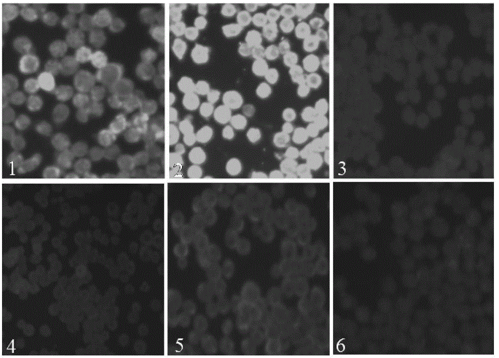 Monoclonal antibody (eeev-6e2) against Eastern equine encephalitis virus e2 protein and its recognized B-cell epitope and application