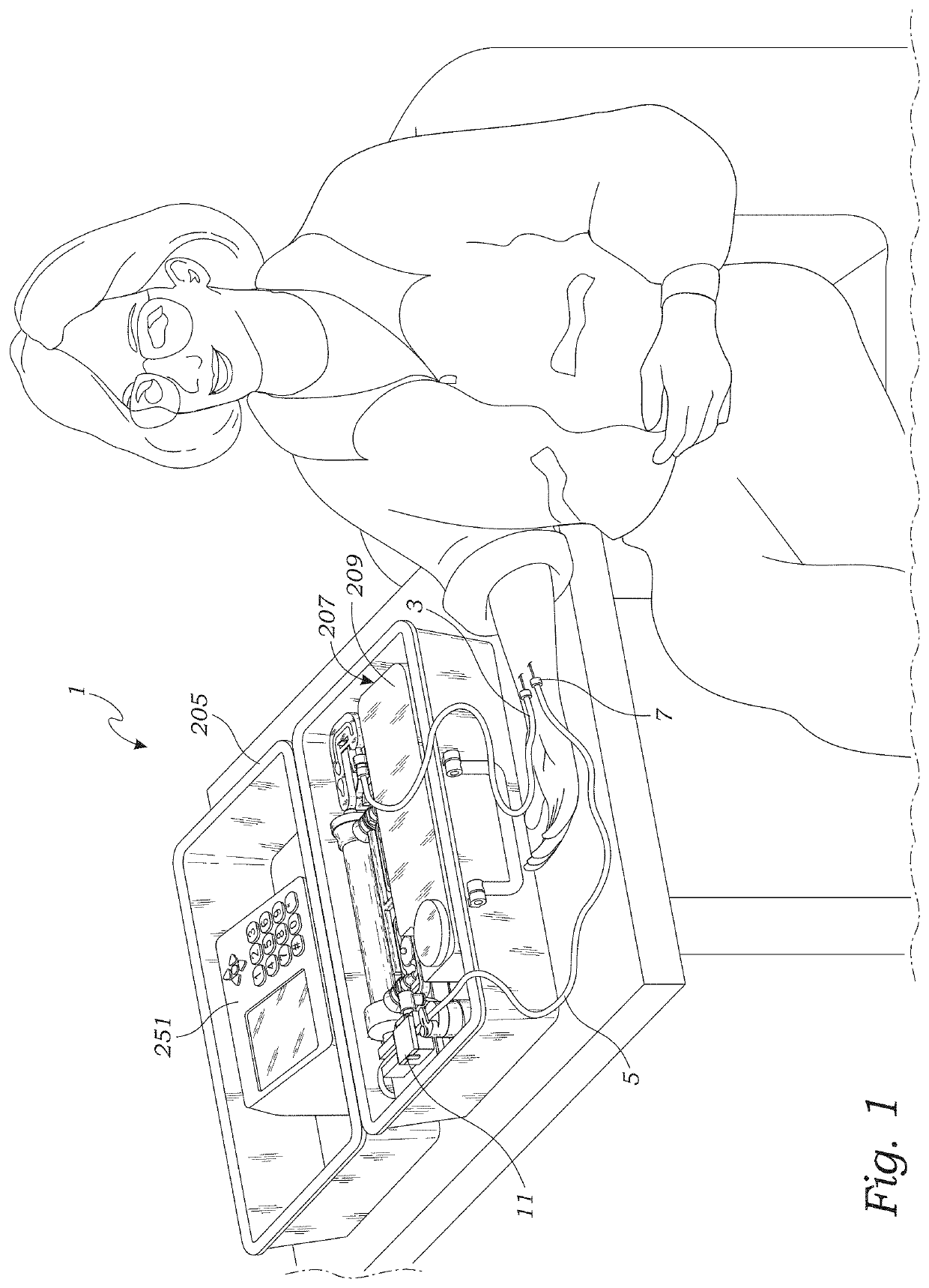 Hemodialysis system with ultrafiltration controller