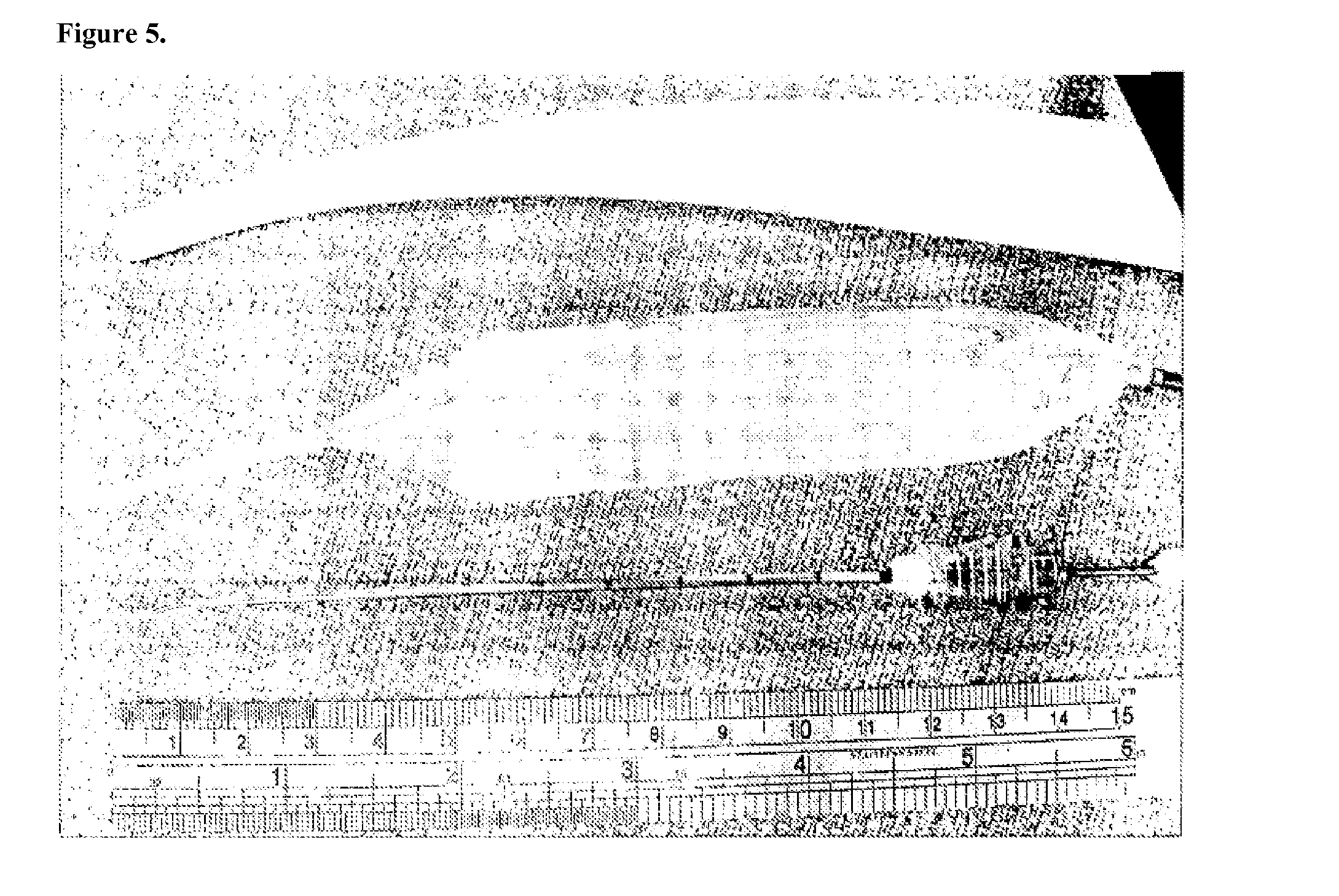 Triaxial antenna for microwave tissue ablation