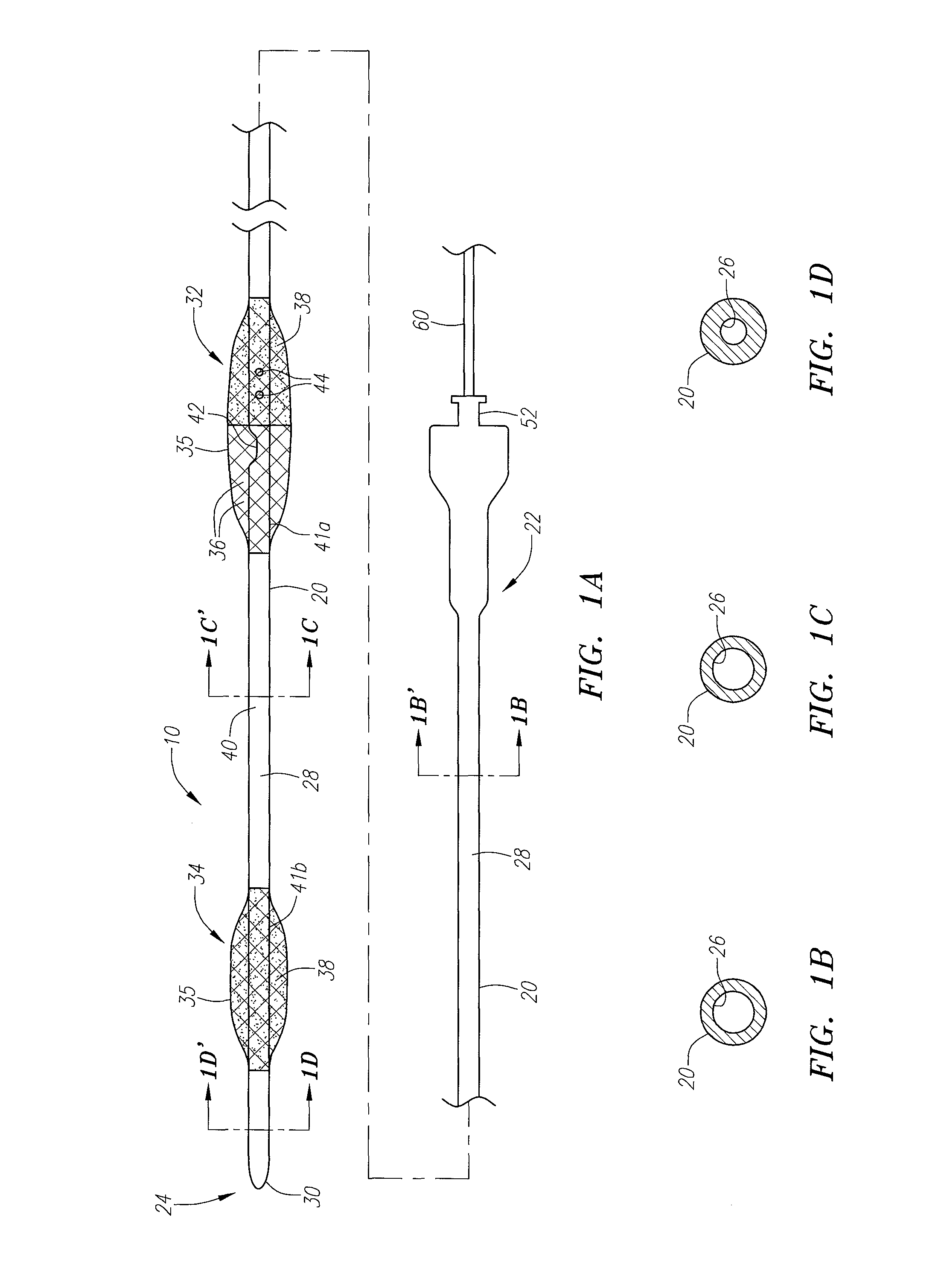 Occlusion device and method of use