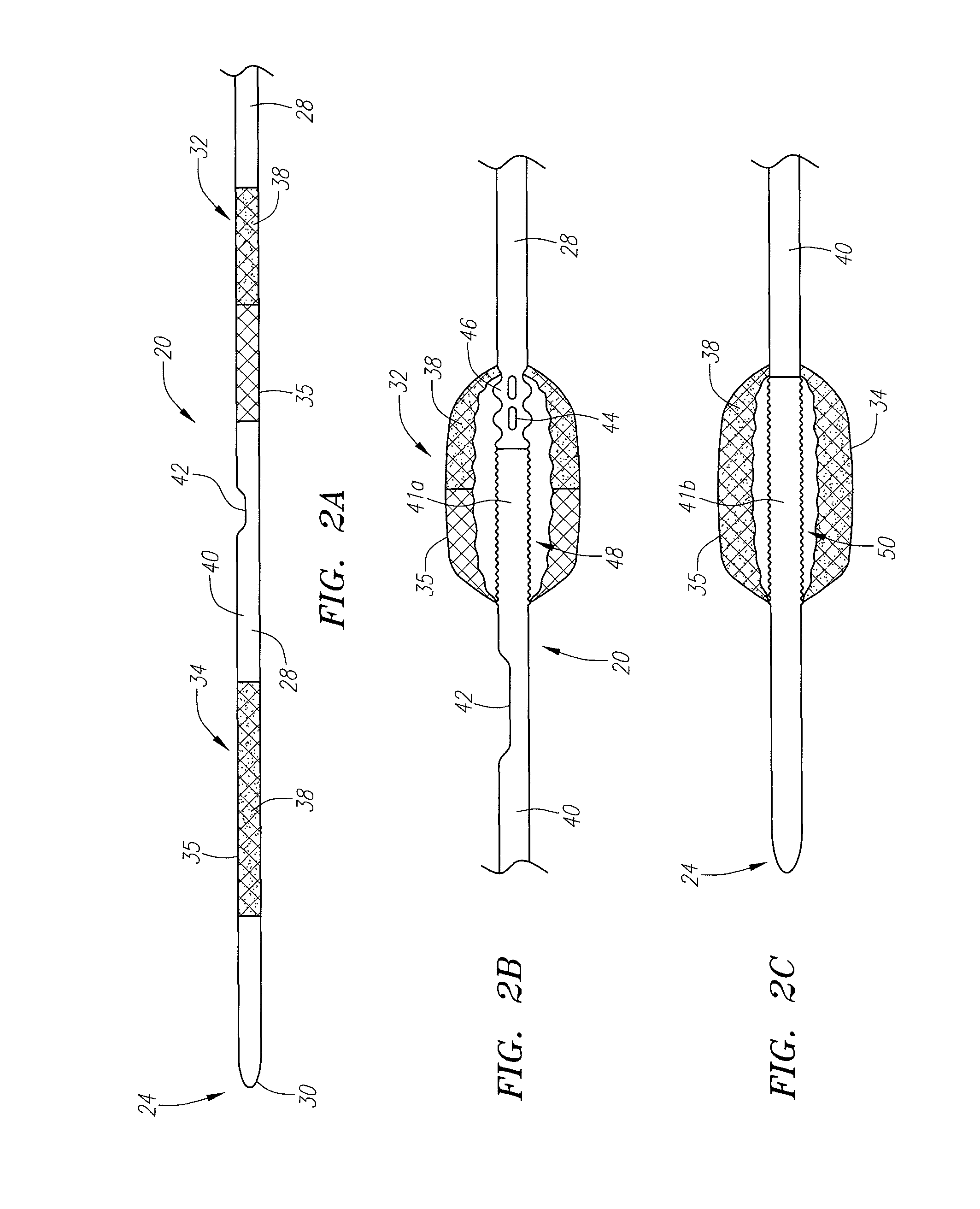 Occlusion device and method of use