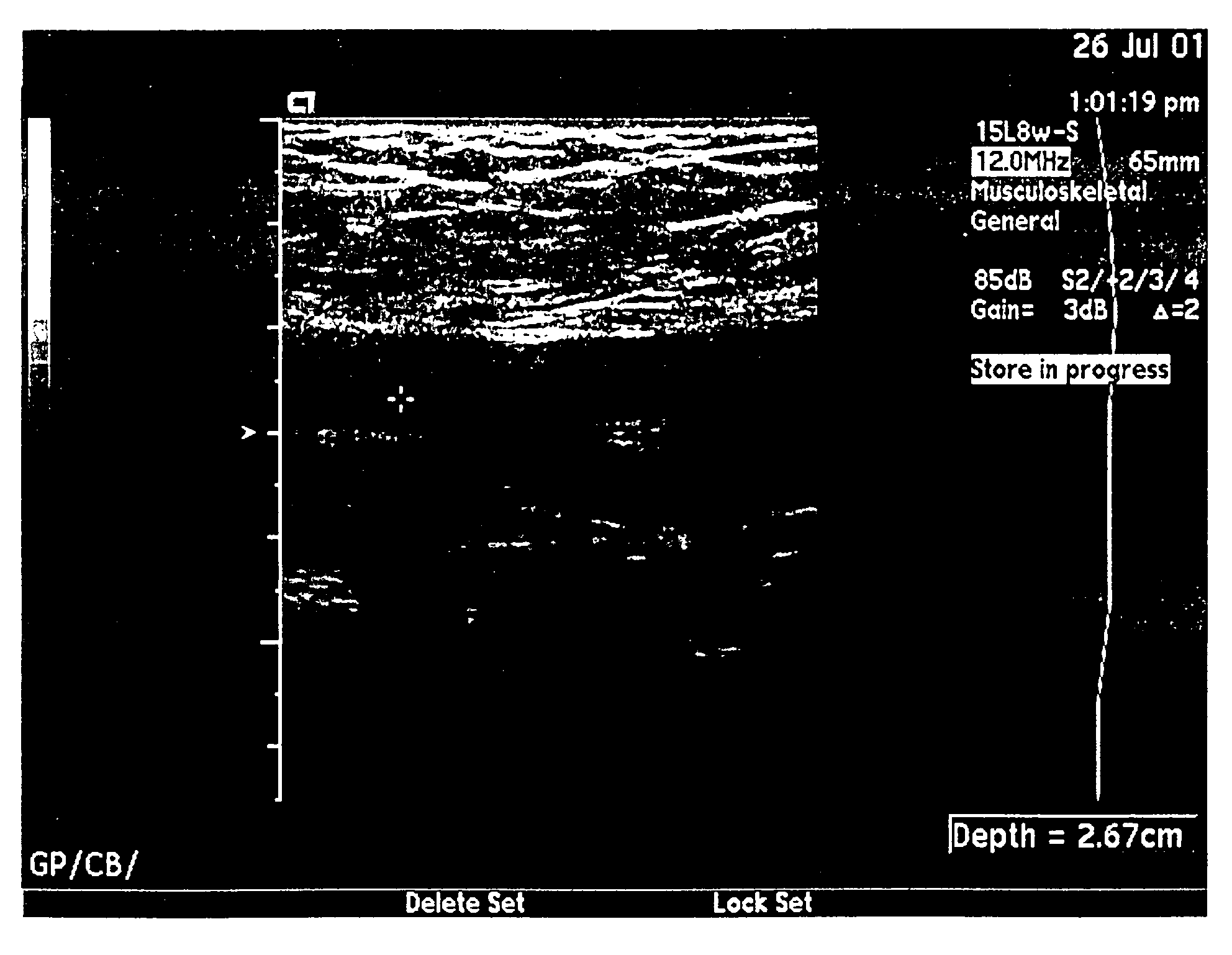 Hemostatic compositions and uses therefor