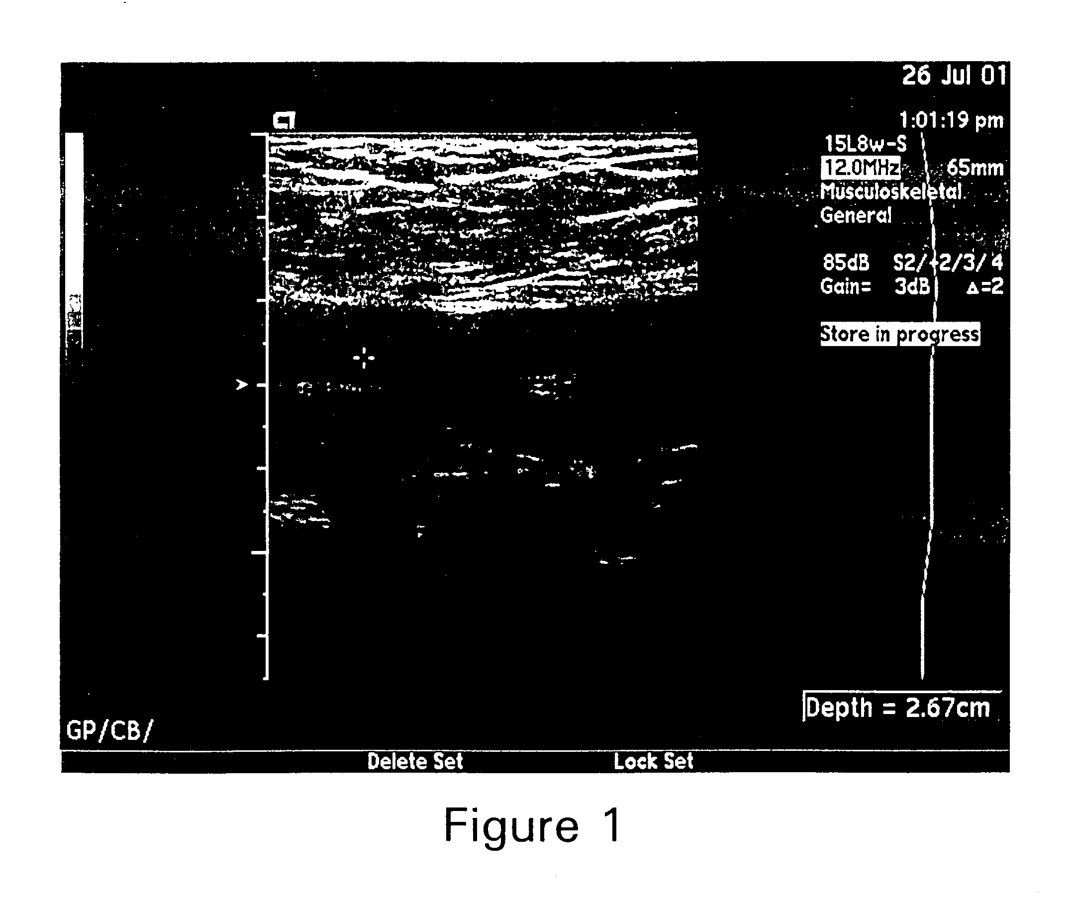 Hemostatic compositions and uses therefor