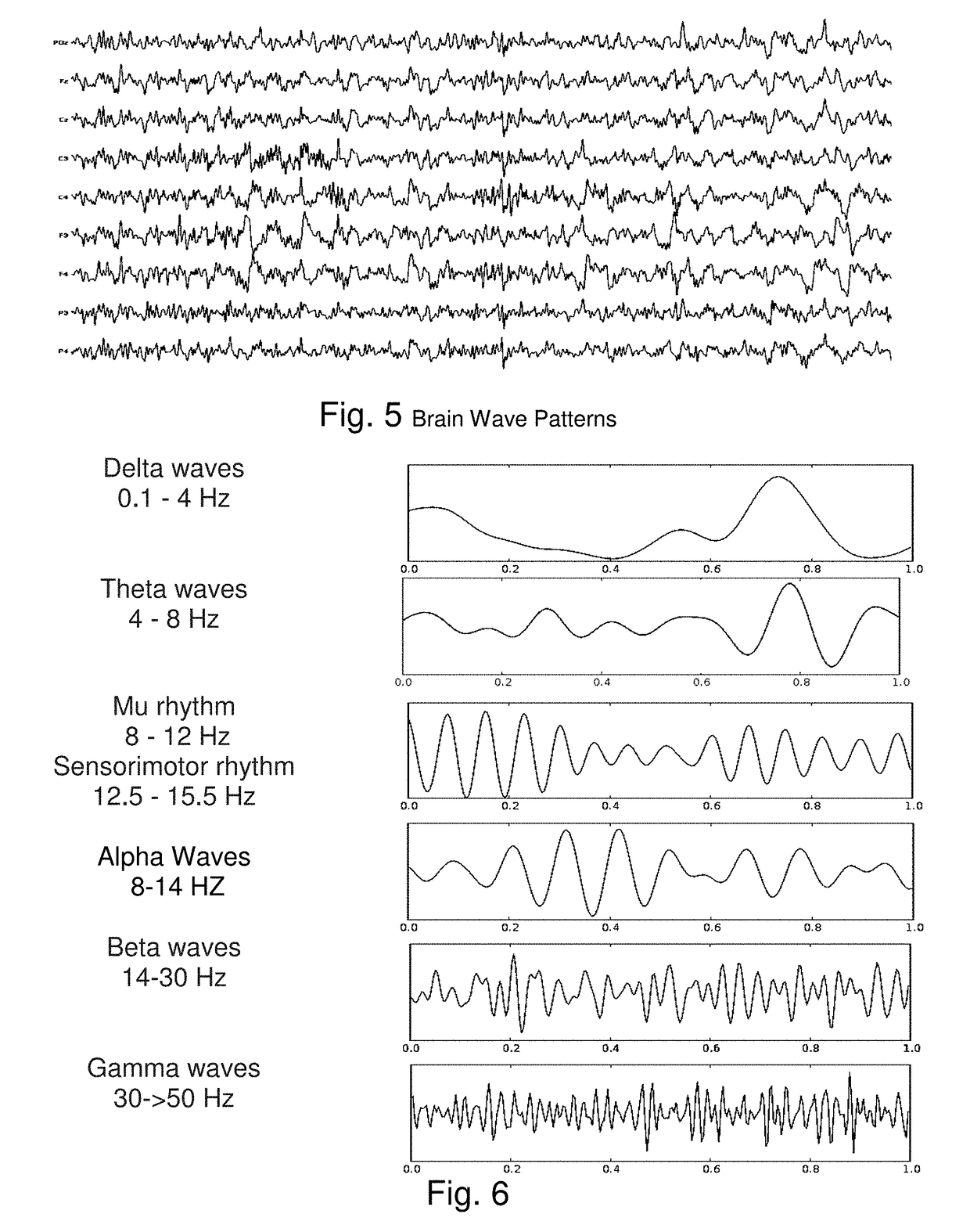 Method and apparatus for neuroenhancement