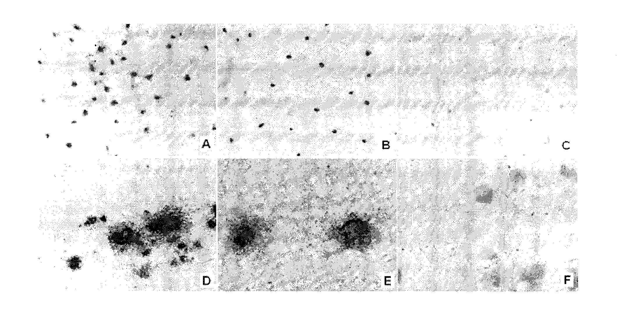 Diagnostic and therapeutic gastric cancer vascular specific binding peptide GEBP11 isotope probe