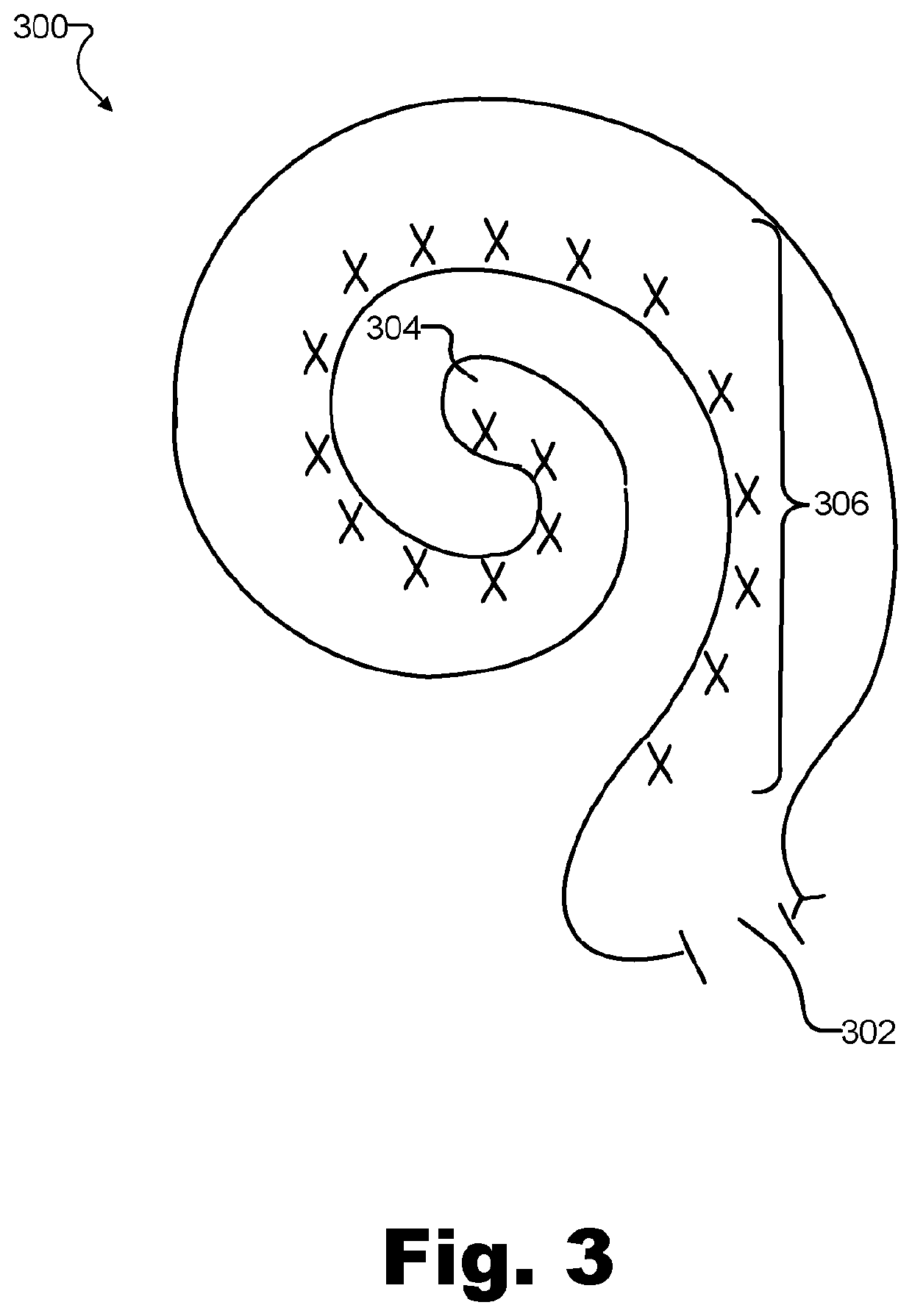 Systems and methods for frequency-specific localization and speech comprehension enhancement