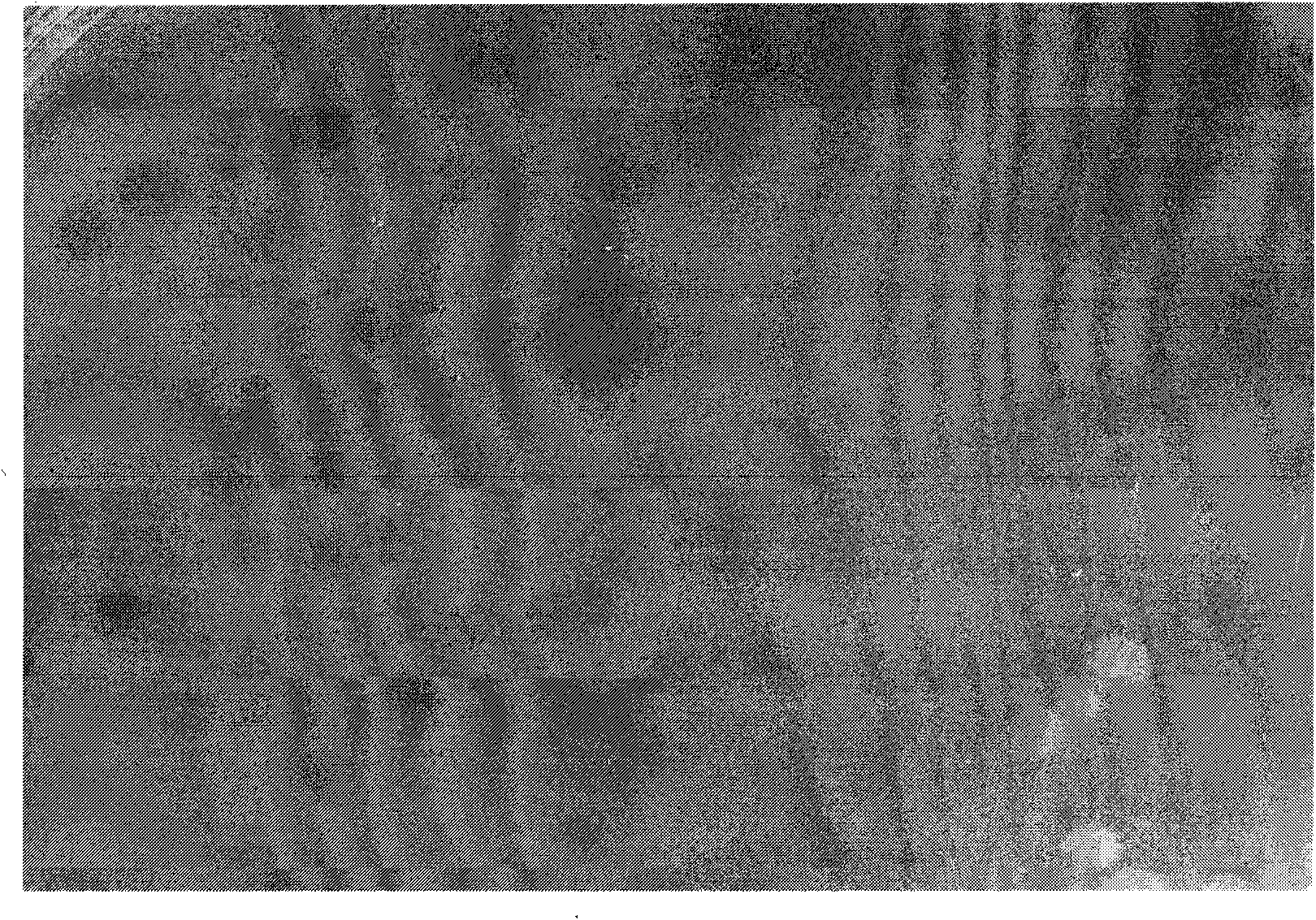 Kit for testing early lung cancer specific autoantibody enzyme linked immunity and preparation method thereof