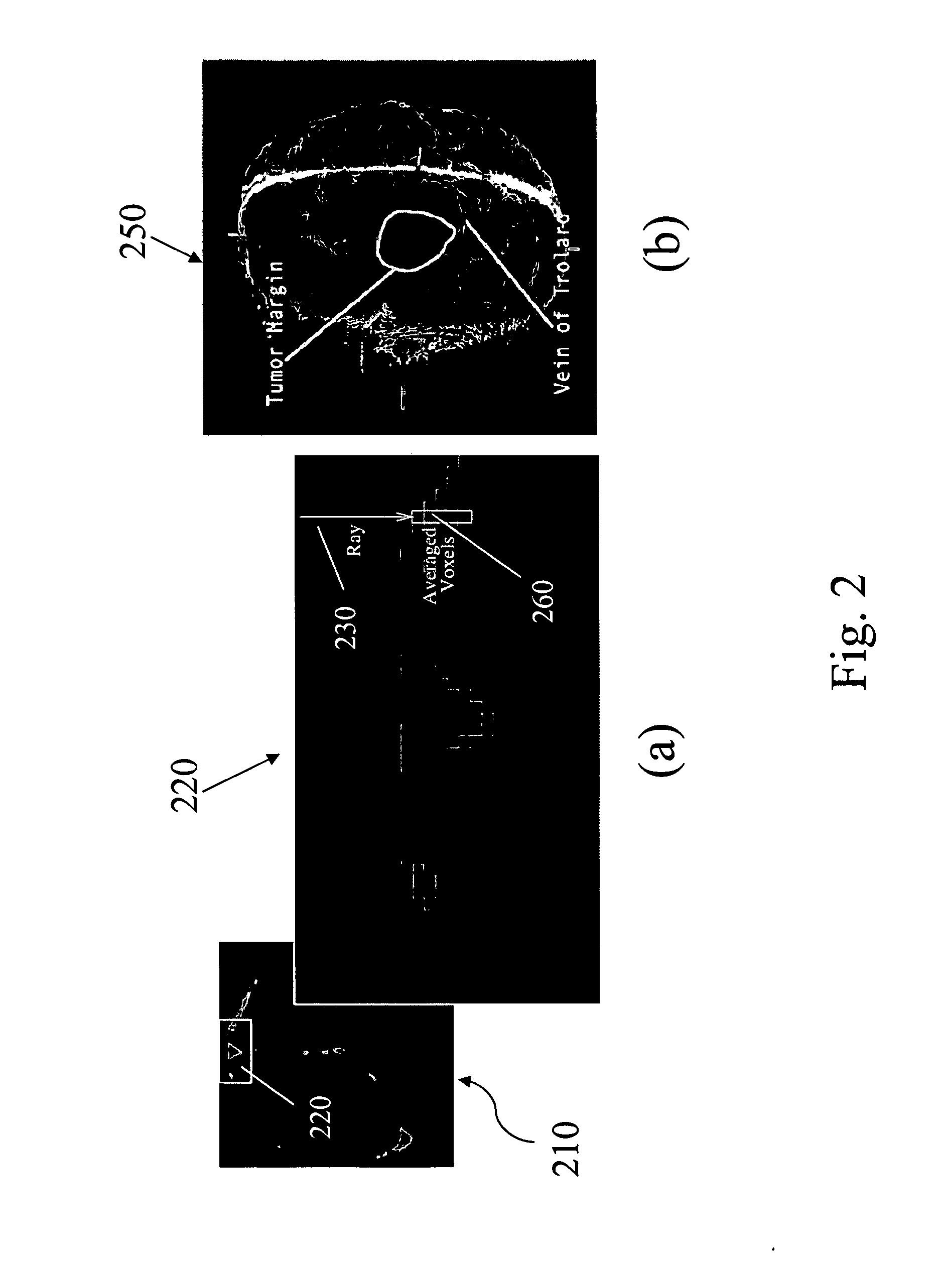 Apparatus and methods of cortical surface registration and deformation tracking for patient-to-image alignment in relation to image-guided surgery