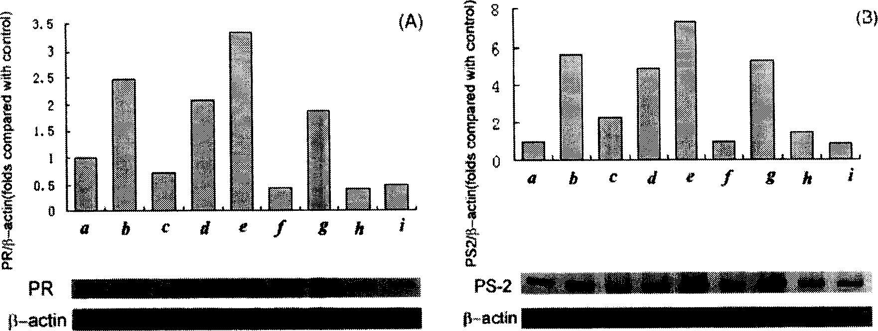 Combination of medication of containing general saponin of notoginseng and icariin as well as usage