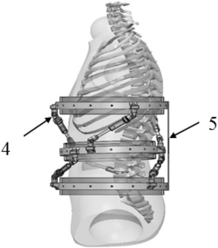 Active type intelligent orthosis for spinal disease rehabilitation therapy