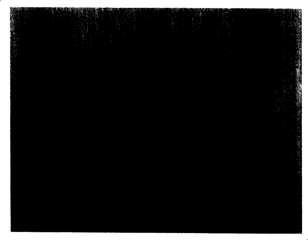 Bifidobacterium possessing characteristic for anti pathogenesis bacterium in intestinal tract and antioxidation, and application