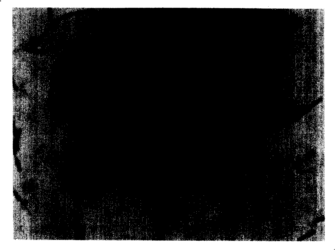 Bifidobacterium possessing characteristic for anti pathogenesis bacterium in intestinal tract and antioxidation, and application