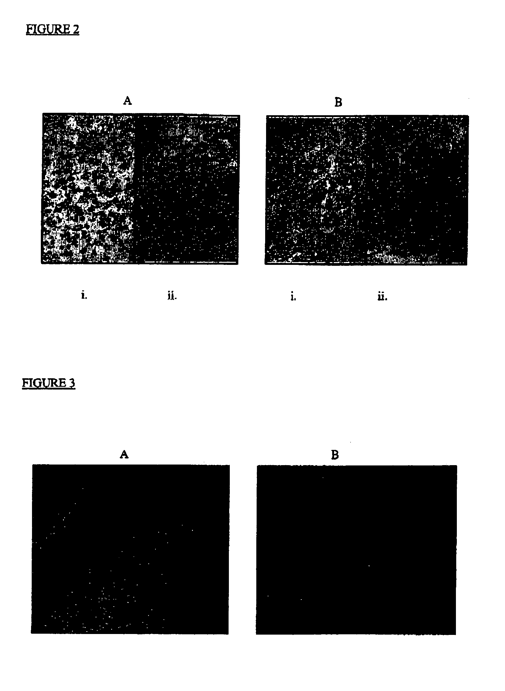 Therapeutic compositions and methods of treating glycolipid storage related disorders