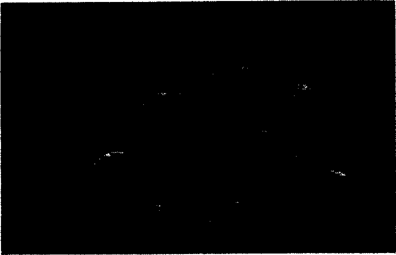 Slow-releasing microball with nimoldipine and its preparing method