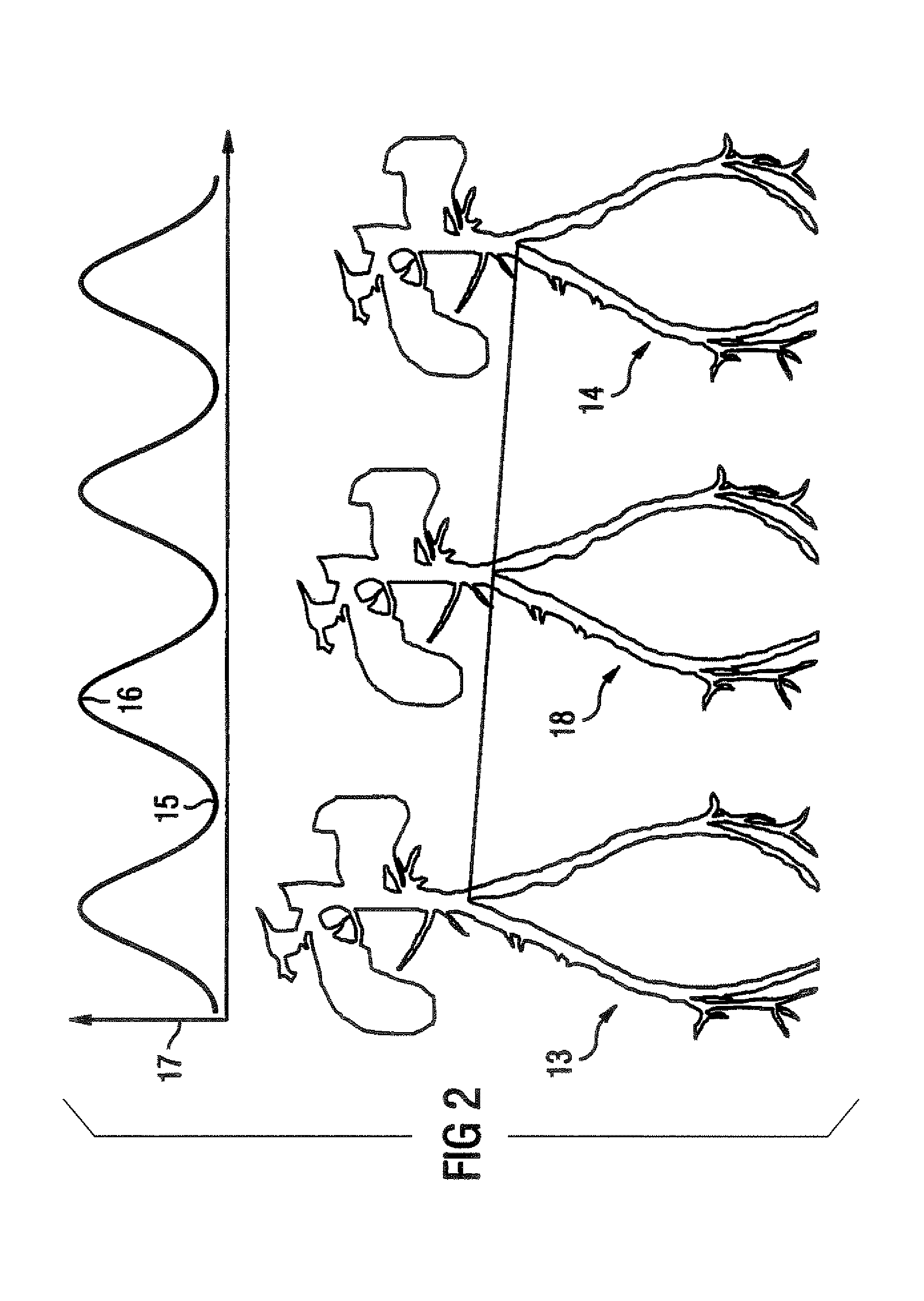 Magnetic resonance tomography method and apparatus with motion correction