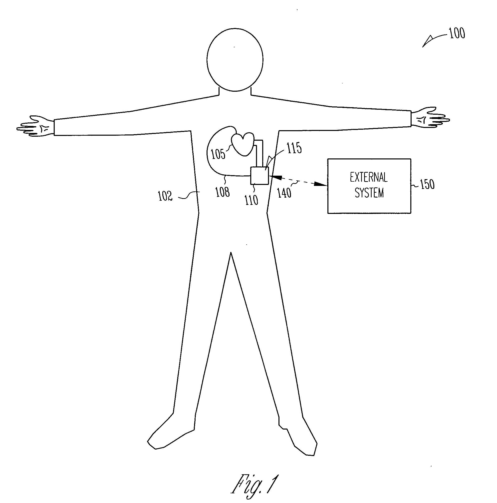 Method and apparatus for modulating cellular growth and regeneration using ventricular assist device