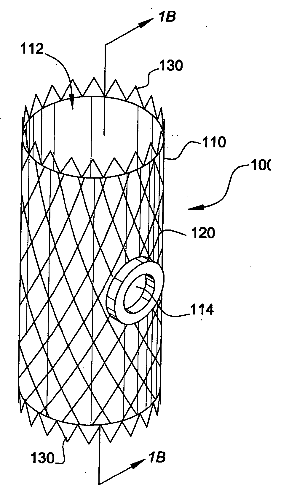 System and method for endoluminal grafting of bifurcated and branched vessels