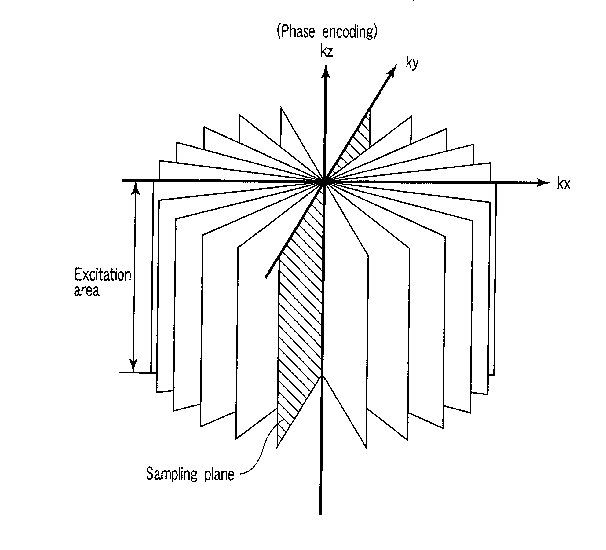 Magnetic resonance imaging system