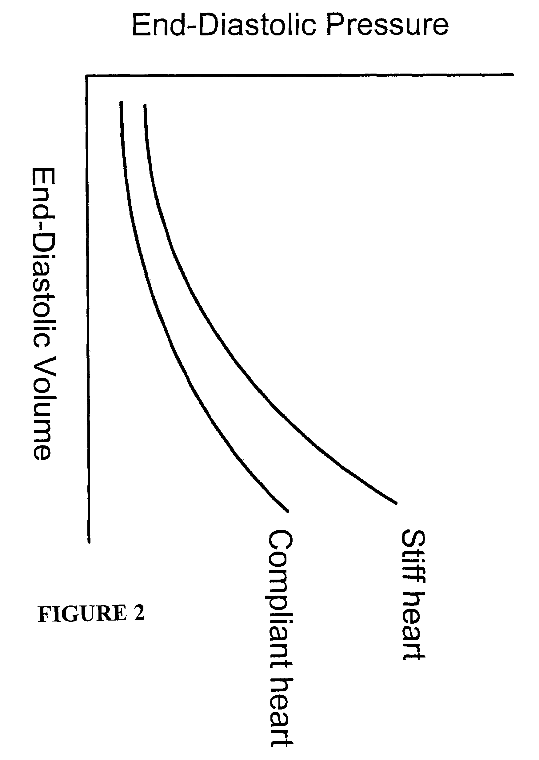 Systems and methods for making noninvasive assessments of cardiac tissue and parameters