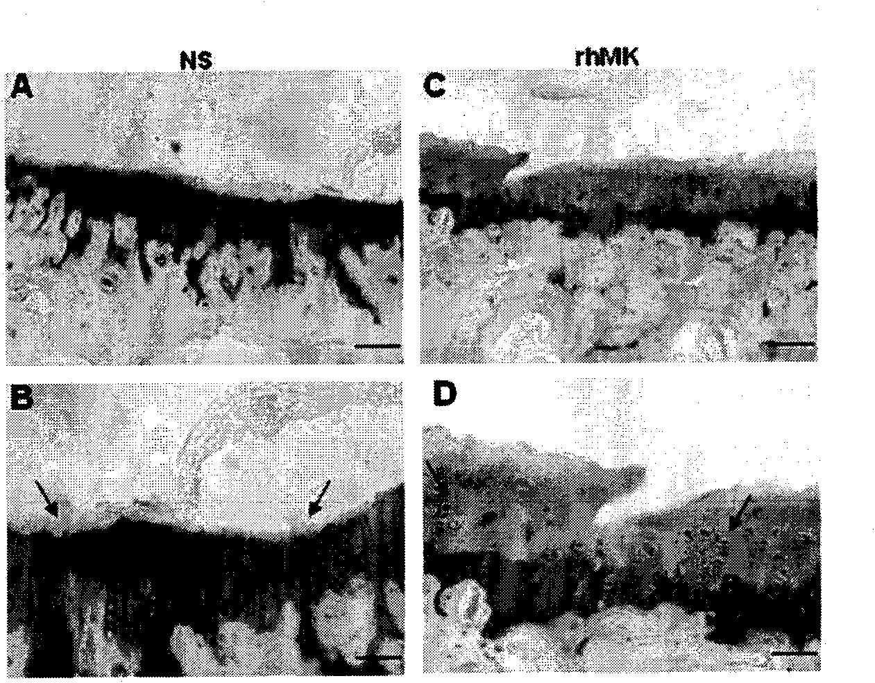 Application of midkine protein and medical device containing protein