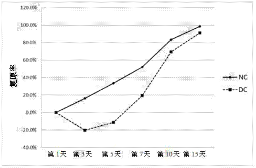 Use of isoquinoline derivatives for diabetic wound healing