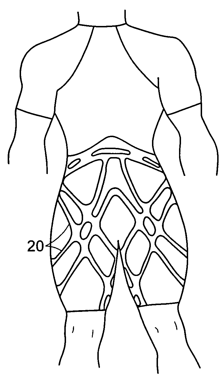 Garment