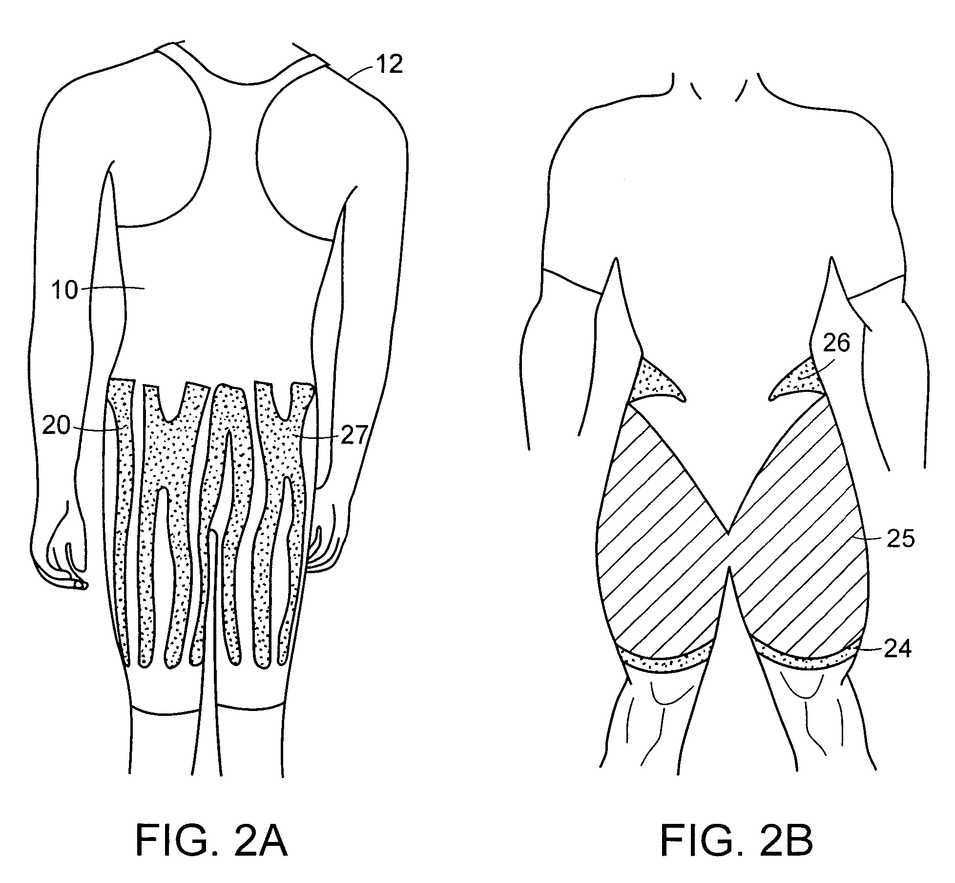 Garment