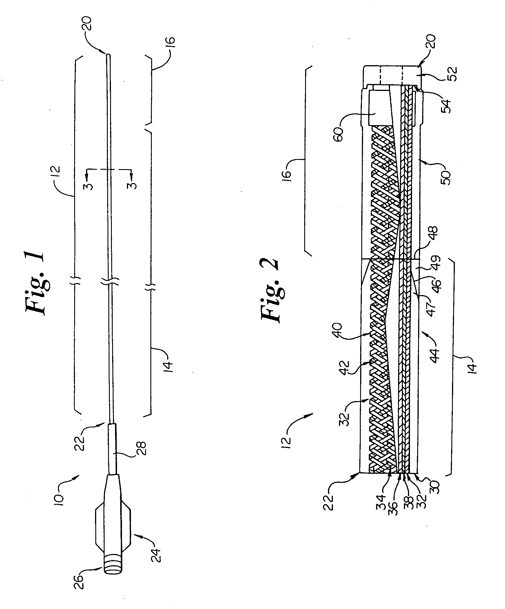 Intravascular catheter with composite reinforcement