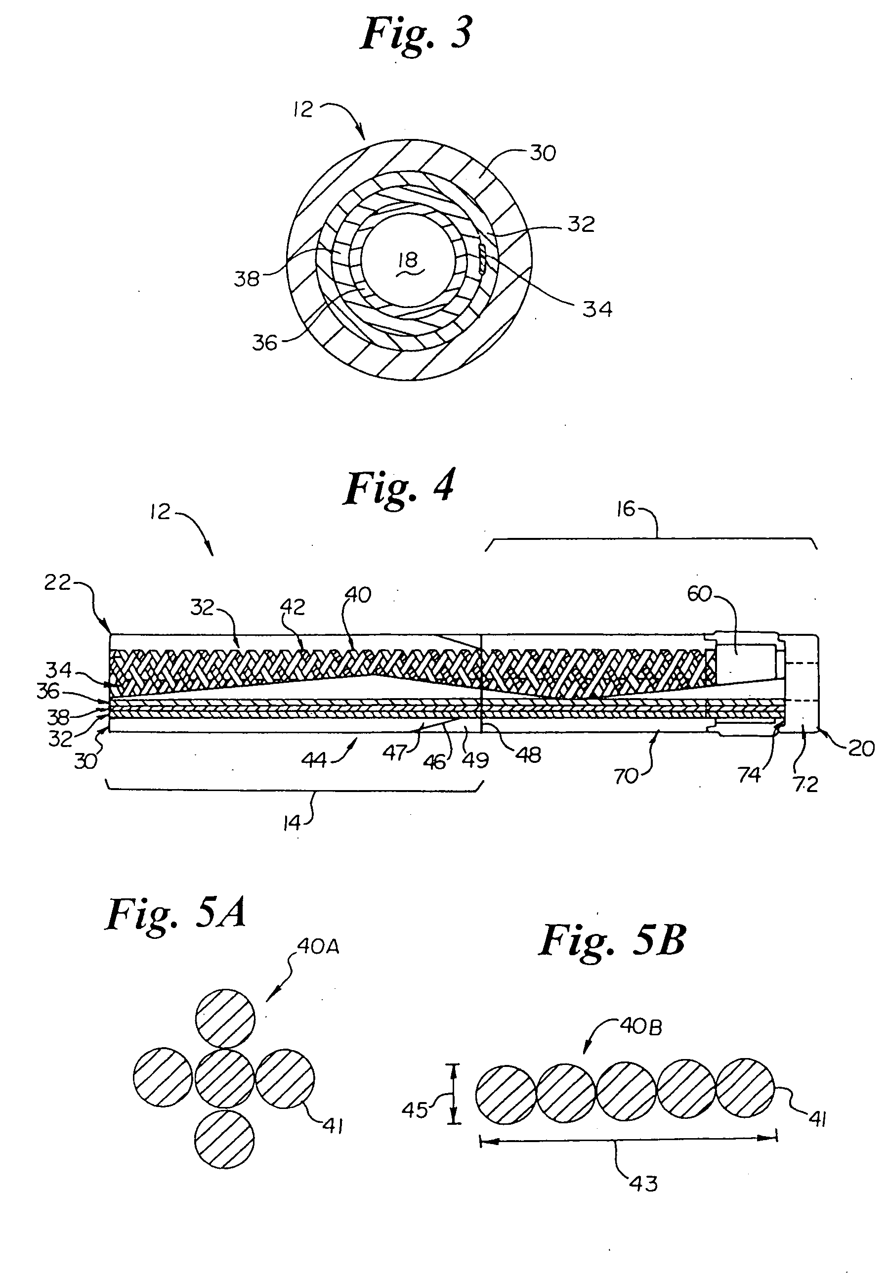 Intravascular catheter with composite reinforcement