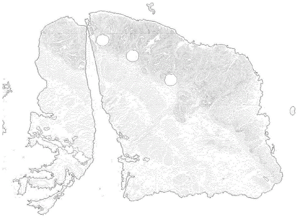 Method for quantifying immune cells in tumoral tissues and its applications