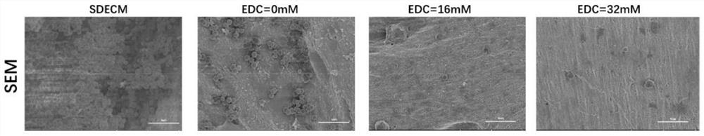 Preparation method of a specific demineralized extracellular matrix scaffold of cross-linked antibiotics