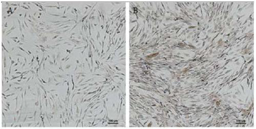 Injection capable of treating androgenetic alopecia with dermal papilla cell exosomes