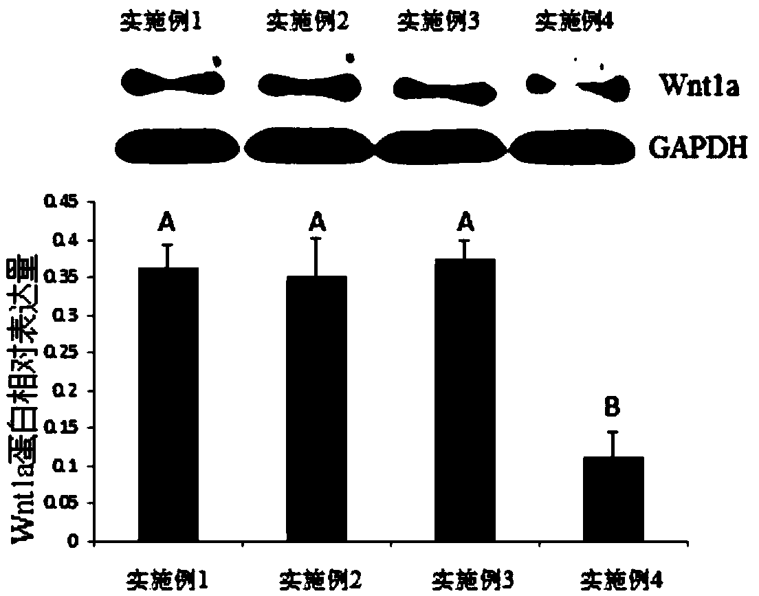 Injection capable of treating androgenetic alopecia with dermal papilla cell exosomes